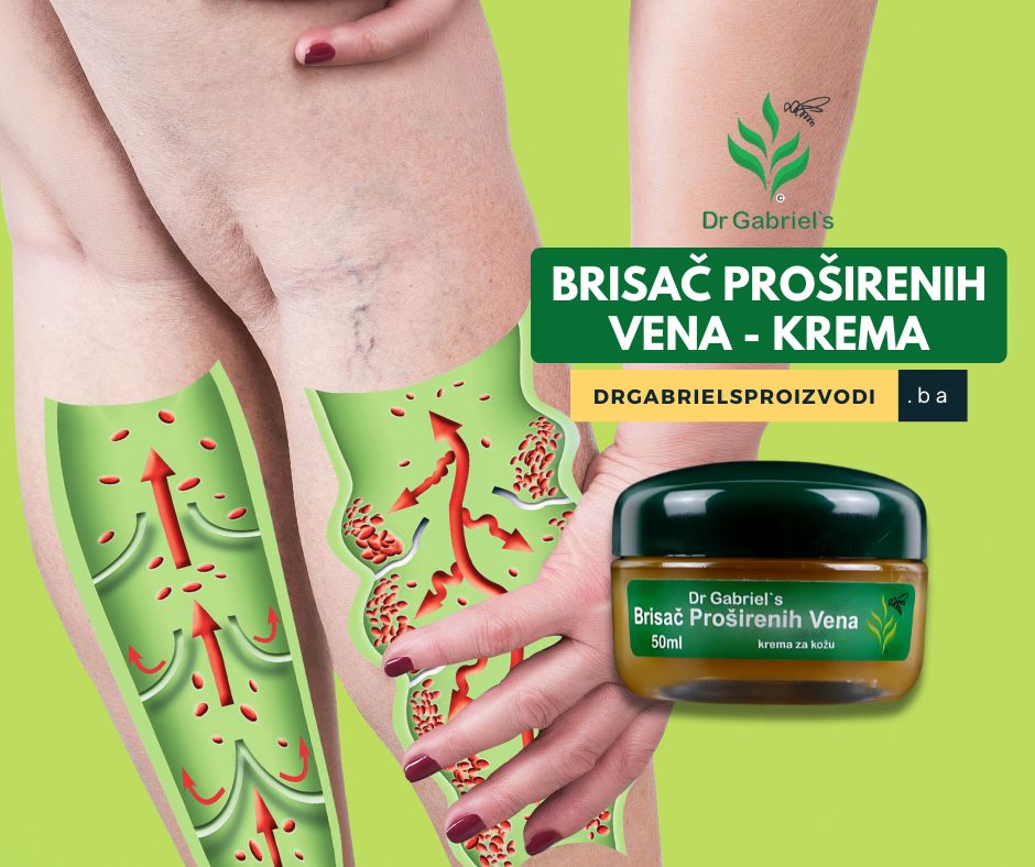 brisač-proširenih-vena